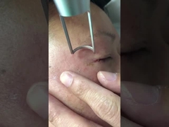 450ps de Machine1064nm 532nm Q Geschakeld Nd Yag van de picosecondelaser