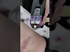 50W Fractionele RF Microneedle Machine 100V tot 240V