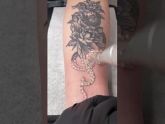 450ps de Machine1064nm 532nm Q Geschakeld Nd Yag van de picosecondelaser