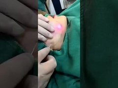 Professionele 1470nm Diode Laser Fat Reduction Machine Zichtbare resultaten in 2-3 sessies