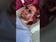 Gezichtslift 585nm 650nm Picosecond Laser Device 500ps 750ps 2000ps